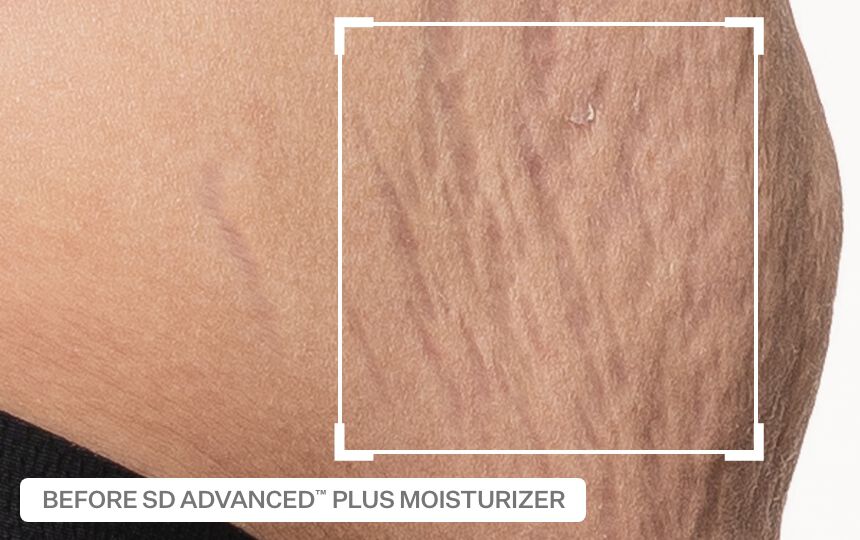 After 4 weeks of use as directed. <br />Individual results will vary. 