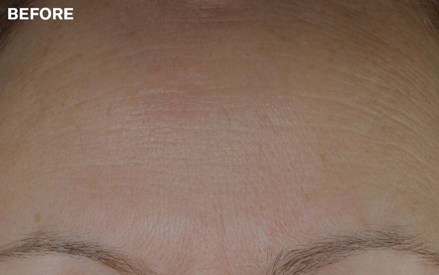 Results after 7 days when used as directed. </p>Individual results will vary