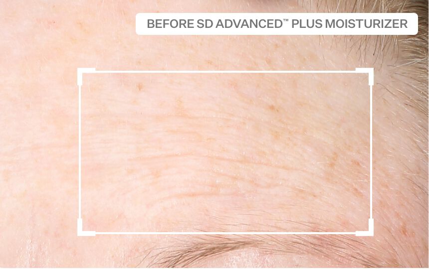 After 4 weeks of use as directed.<br /> Individual results will vary