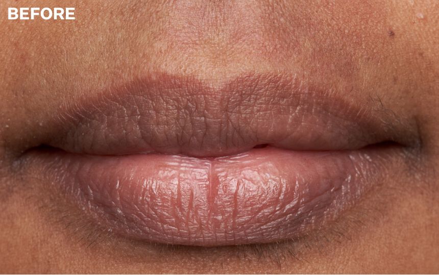 Based on results 1 hour after application. </p>Individual results will vary