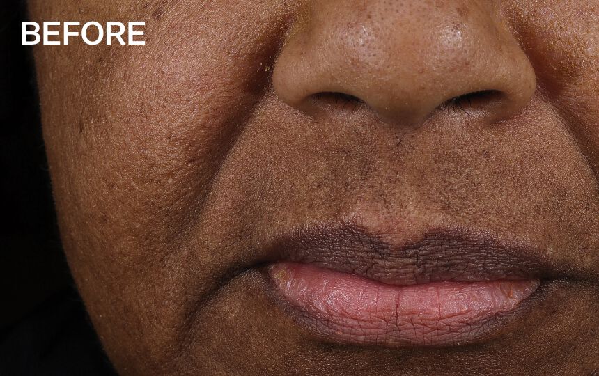 After 8 weeks of use as directed. <br>Individual results will vary.