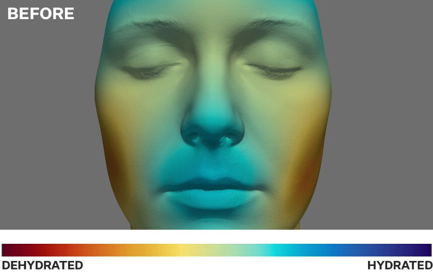 This technology visually maps the instrumental testing results to showcase the increase of hydration and balancing of moisture throughout the entire face after applying Re-Quench Water Cream. </p>Based on average results from instrumentation testing  on 31 subjects