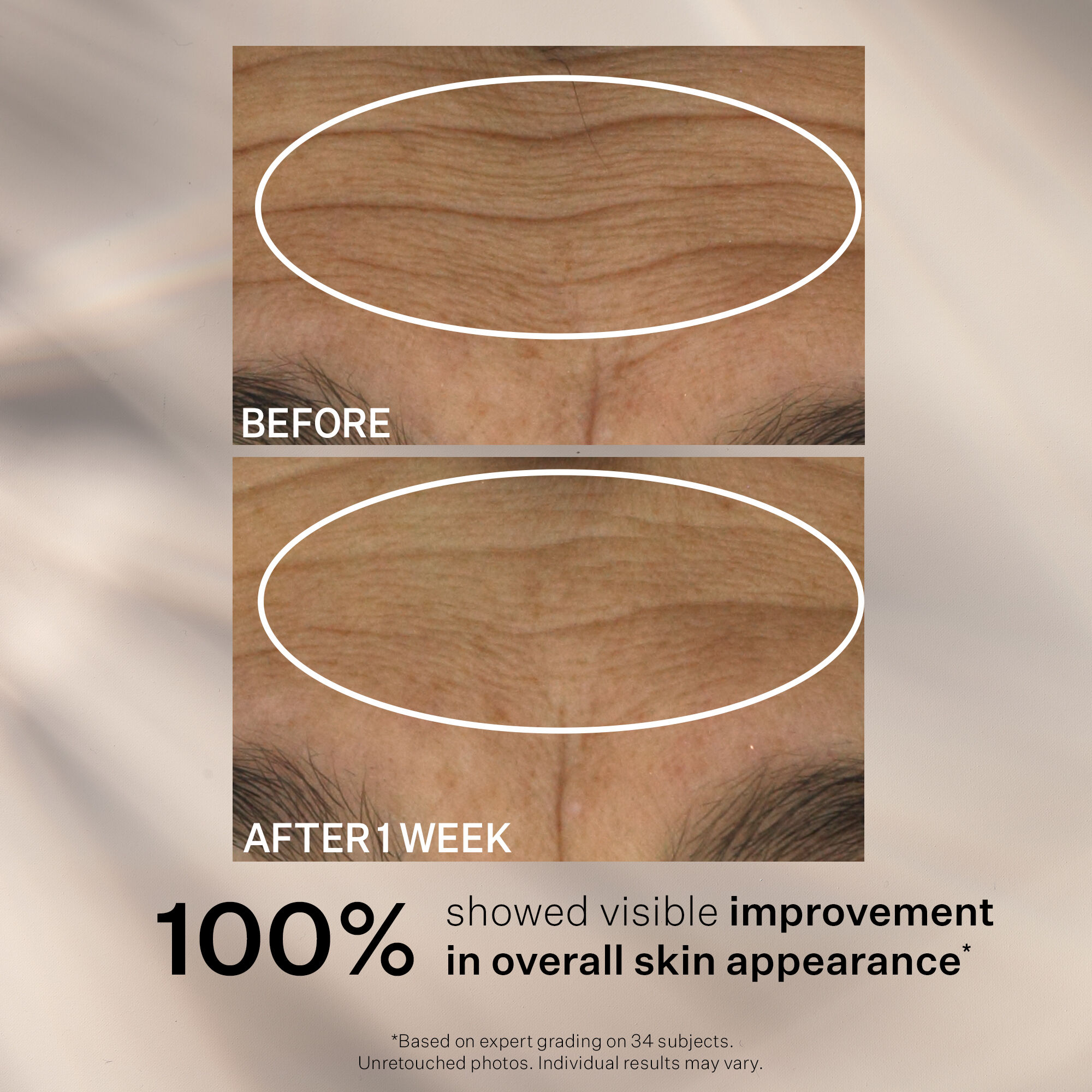 Wrinkle Recode™ Moisture Rich Barrier Cream | Moisturisers