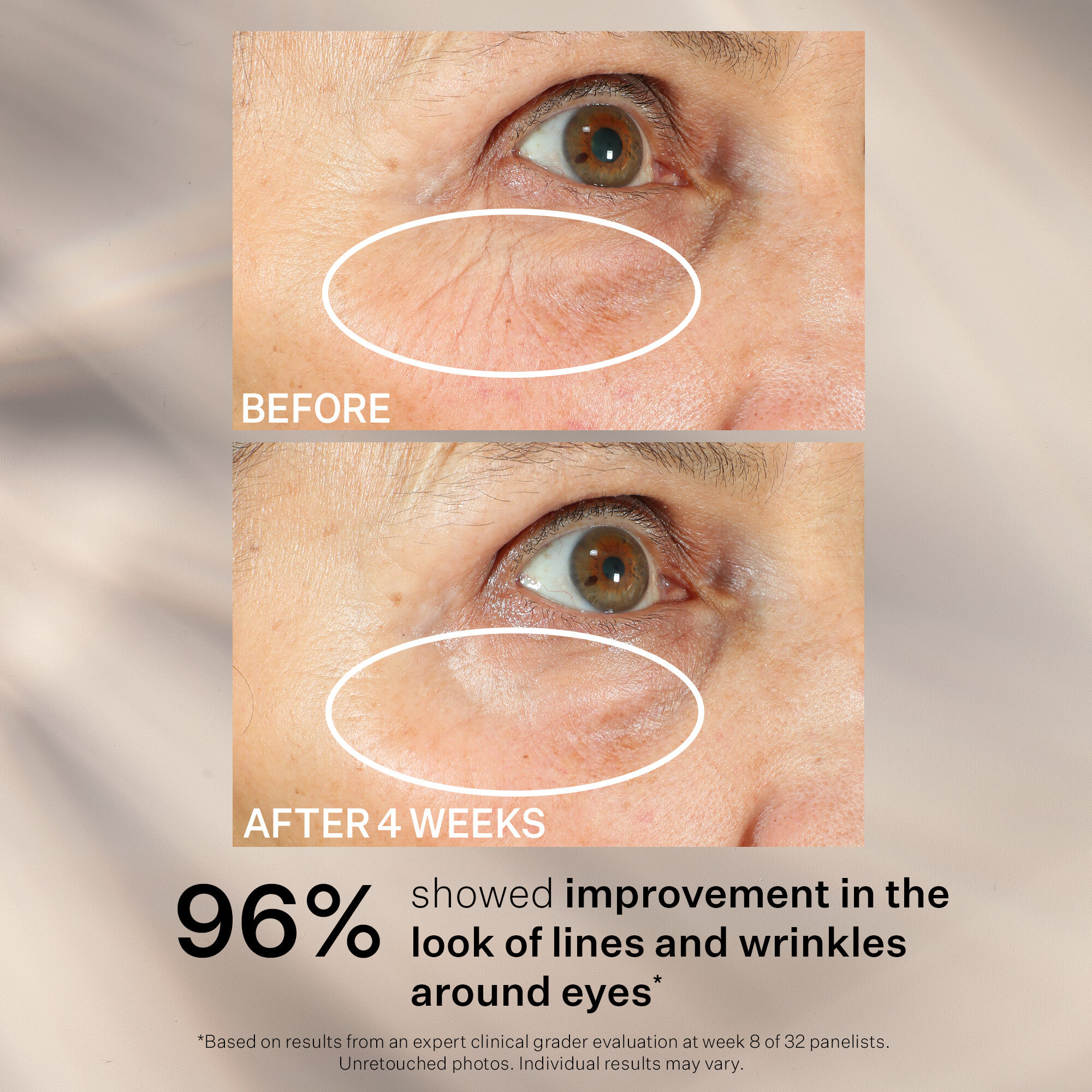 Peptight™ 360° Tightening Eye Serum | Eye Care | Strivectin UK