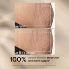 SD Advanced™ Plus Intensive Moisturiser