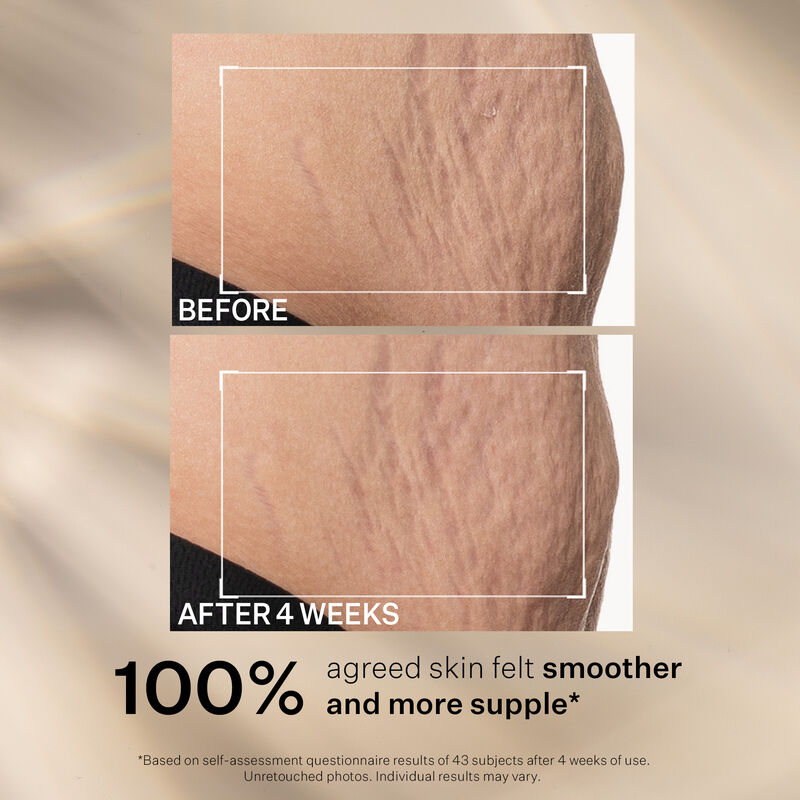 SD Advanced™ Plus Intensive Moisturiser