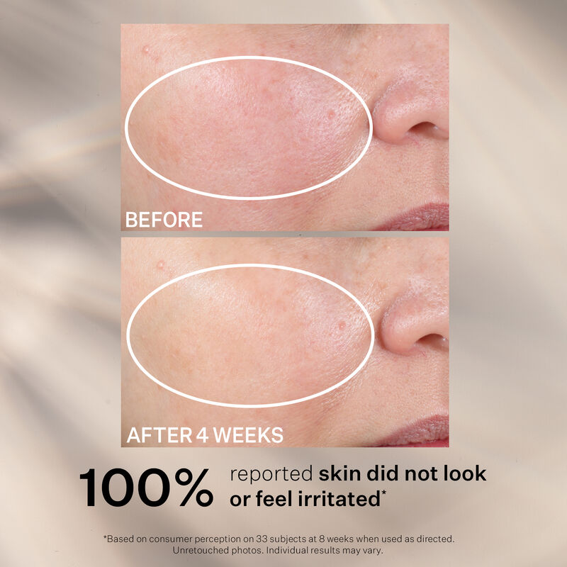 Advanced Retinol Nightly Renewal Moisturizer