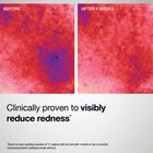 Barrier Restore+ Soothing Ceramide Cream, , hi-res