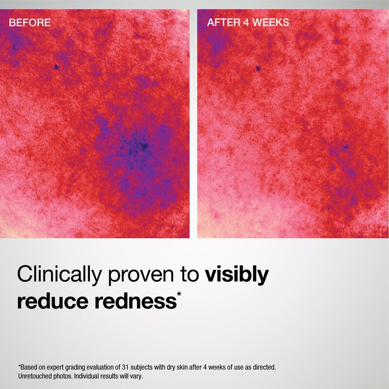 Barrier Restore+ Soothing Ceramide Cream, , hi-res