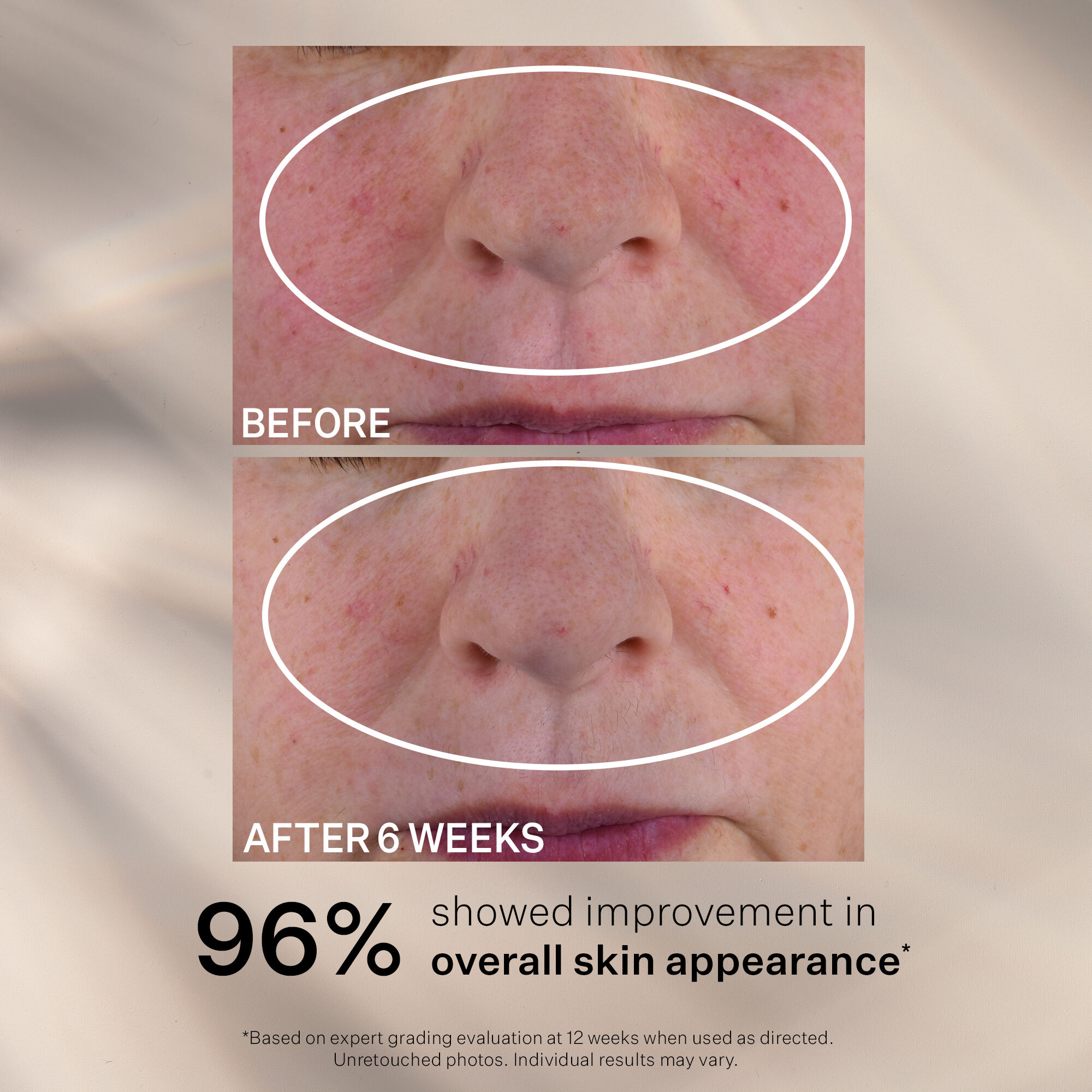 Advanced Retinol Nightly Multi-Correct Serum | Serums