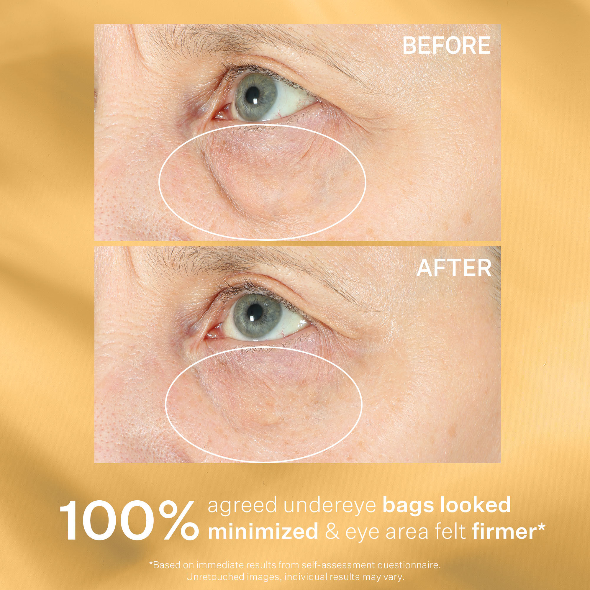 Hyperlift Eye™ Instant Eye Fix | Eye Care | Strivectin UK