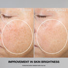 Super-C Retinol Brighten & Correct Vitamin C Serum