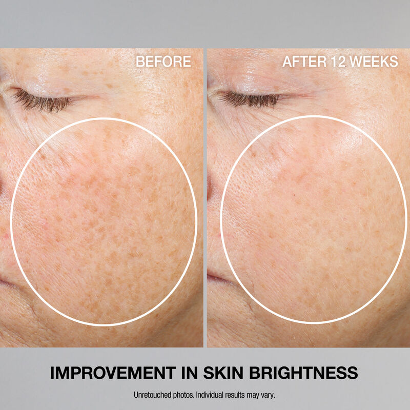 Super-C Retinol Brighten & Correct Vitamin C Serum