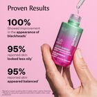 100% showed improvement in the appearance of blackheads*, 95% reported skin looked less oily*, 95% reported skin appeared balanced
