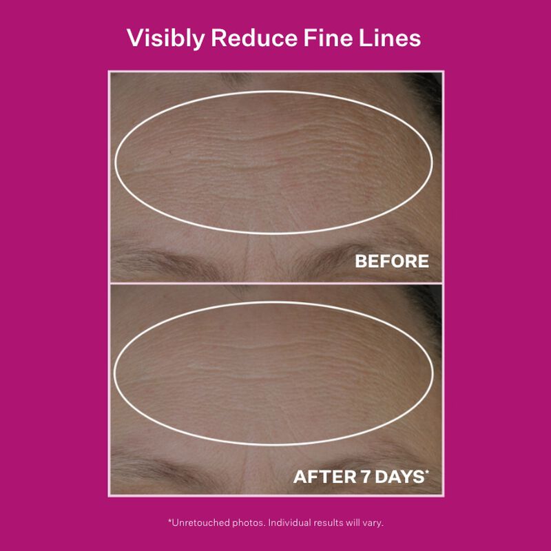 Results of using Peptide Plump™ Line Filling Bounce Serum​