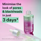 Minimise the look of pores and blackheads in just 3 days