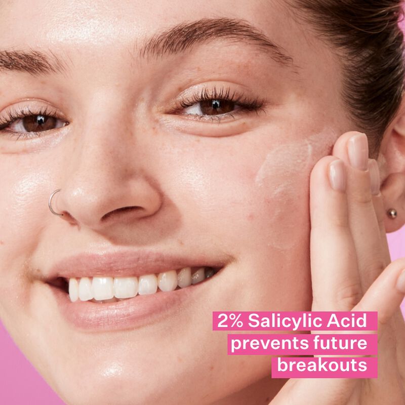 Salicylic Acid prevents future breakouts